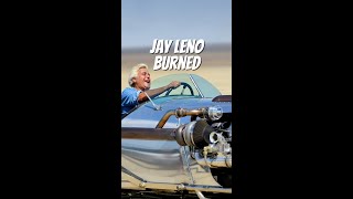 Jay Leno Hospitalized Because of Steam Car [upl. by Bocock708]