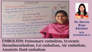 EMBOLISM  Pulmonary Systemic Thromboembolism Fat Air Amniotic Fluid Embolism [upl. by Rollie]