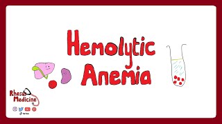 HEMOLYTIC ANEMIA Extravascular v Intravascular Clinical Features Diagnosis Coombs Test  Rhesus [upl. by Ury]