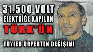 ELEKTRİĞE KAPILAN TÜRKÜN TÜYLER ÜRPERTEN DEĞİŞİMİ [upl. by Grogan135]