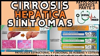 CIRROSIS HEPÁTICA SÍNTOMAS  GuiaMed [upl. by Jourdain]