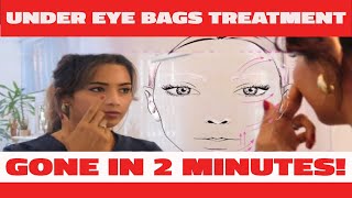 I tried quotThisquot Under Eye Bags Treatment That Works in 2 Minutes [upl. by Froemming]