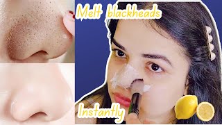 DIY Blackhead Peel Off Mask with an Egg  It Actually WORKS 😲✨ Blackheads Removal on face [upl. by Amehsyt]