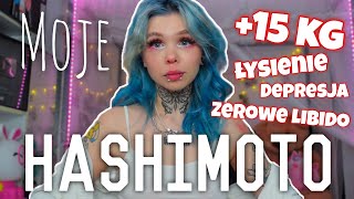 ♦️Jak żyję z HASHIMOTO♦️Moja Historia [upl. by Hairabez]