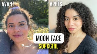 Sopk  Comment diminuer la quotMOON FACEquot   rétention deau maigrir du visage [upl. by Notelrac]