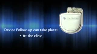 What is an Implantable Cardioverter Defibrillator ICD [upl. by Nwadal]