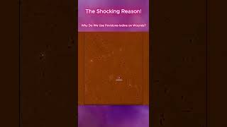 Why Do We Use PovidoneIodine on Wounds [upl. by Carey]