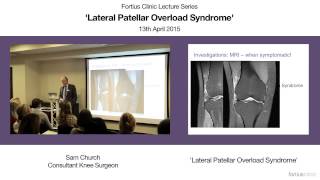 Lateral Patellar Overload Syndrome [upl. by Giess383]