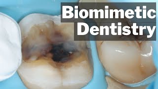 Biomimetic Dentistry  What Actually Is It  PDP135 [upl. by Winston]