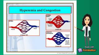 Hyperemia and Congestion  fluid and hemodynamics  pathology [upl. by Tanny]