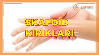 SKAFOİD KIRIKLARI VE TEDAVİSİ [upl. by Petit137]