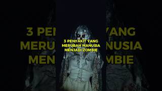 3 Penyakit Yang Merubah Manusia Menjadi Zombie Creepy Horror Zombie Rabies [upl. by Obed]