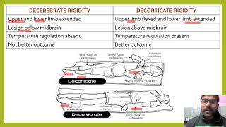 DIFFERENCE BETWEEN DECEREBRATE AND DECORTICATE RIGIDITY DECORTICATERIGIDITY DECEREBRATERIGIDITY [upl. by Alexandre]