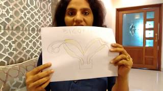 प्रेगनेंसी न ठहरने का एक बड़ा कारण  Bicornuate Uterus Diagnosis [upl. by Aihsyt68]