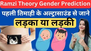 Ramzi method or Theory for Gender Prediction  Baby Boy Symptoms During pregnancy Ultrasound Report [upl. by Perce]