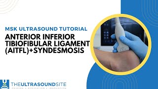 Musculoskeletal ultrasound tutorial  Anterior inferior tibiofibular ligament AITFLsyndesmosis [upl. by Rramel372]