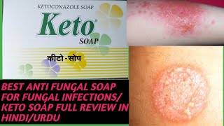 BEST SOAP FOR FUNGAL INFECTIONS AND ITCHENG AND RASHESKETO SOAP FULL REVIEW IN HINDIURDU [upl. by Nnitsuj]