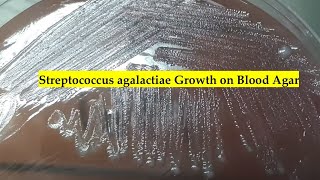 Streptococcus agalactiae Growth on Blood Agar Urine Culture Findings [upl. by Bashee]