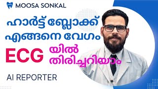 ECG ബ്ലോക്കുകൾ തരം തിരിച്ചുള്ള വിശദീകരണം [upl. by Simona]