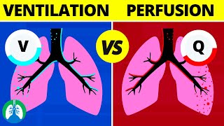 VentilationPerfusion VQ Ratio  Quick Medical Overview [upl. by Syramad]