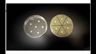 Evaluation of antimicrobial agents Part 1 Microbiology by Ms Bhagyashri Parab [upl. by Gallagher]