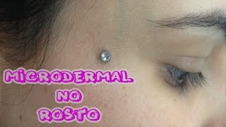 Microdermal no rosto  Microdermal the face [upl. by Parfitt]