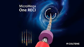 Micromega OneRECI [upl. by Hotze]