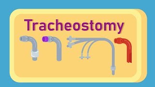 What is Tracheostomy [upl. by Naloc]