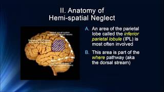 Cognition 3 6 Hemispatial Neglect amp Simultagnosia [upl. by Sekyere]