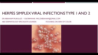 HERPES SIMPLEX VIRUS 1 amp 2 INFECTIONSeducation funny skincondition std skindisease [upl. by Nnanaej]