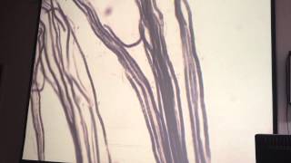 Myelinated nerve fibers [upl. by Rus]