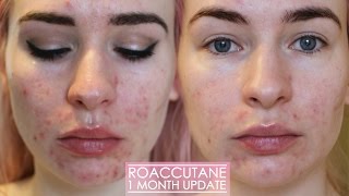 1 MONTH ROACCUTANE UPDATE  Side effects amp my skin now [upl. by Annoel470]