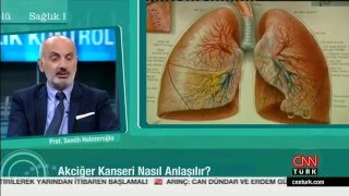 Akciğer Kanseri Cerrahi Tedavisi  CNN Turk [upl. by Hibbert]