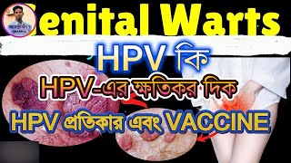 HPV কি HPV এর ক্ষতিকর দিক। HPV এর প্রতিকার। HPV এর প্রতিরোধ । HPV vaccine What is hpv [upl. by Leamiba]