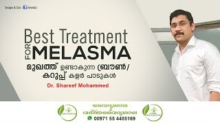 Melasma Malayalam  മുഖത്തു ഉണ്ടാവുന്ന കറുത്ത പാടുകള്‍  Mukhathe Karutha Padukal Maran Dr Shareef [upl. by Taber]