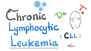 Chronic Lymphocytic Leukemia CLL  Diagnosis and Treatment Hematology and Oncology Series [upl. by Hnirt]