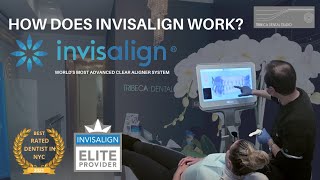 How does Invisalign work [upl. by Aniretake]