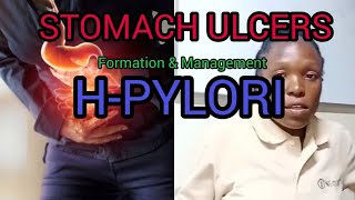 Stomach Ulcers Hpylori FORMATION and MANAGEMENT [upl. by Nossah6]