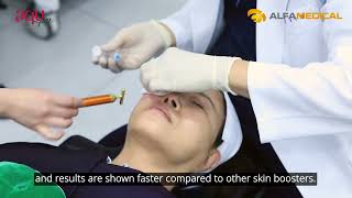 aquPN Skin Booster procedure with Needle Injection  2024 Wyne by Dr Kim [upl. by Greeley705]