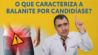 O que caracteriza a balanite por candidíase [upl. by Canfield609]