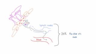 West Nile Virus  Pathogenesis Clinical Presentation and Diagnosis [upl. by Juliane]