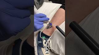 Laser Tattoo Removal [upl. by Drexler777]