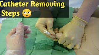 How to Remove Catheter new Video  Male Catheter Removal Steps  How to Remove Female Catheter [upl. by Brodeur988]