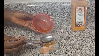 Natural remedy for dark spot remover and hyperpigmentation  MiatorV DIY [upl. by Cowan]