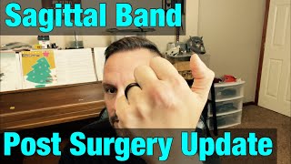 Sagittal Band Surgery Update [upl. by Alessandro]