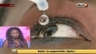 SANTE la conjonctivite Apolo dans Petit Dej du 07 nov 2016 avec Amina [upl. by Siulegroj]