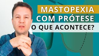 MASTOPEXIA COM PRÓTESE O que acontece após a cirurgia [upl. by Tiertza96]