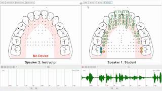 SmartPalate EPG System Demo [upl. by Pauletta]