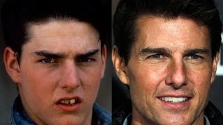 20 Photos Of Celebrities Teeth before amp after That prove good teeth means good face [upl. by Assenahs]