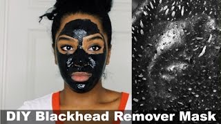 DIY Blackhead Remover Peel Off Mask  Removes EVERYTHING [upl. by Aliet]